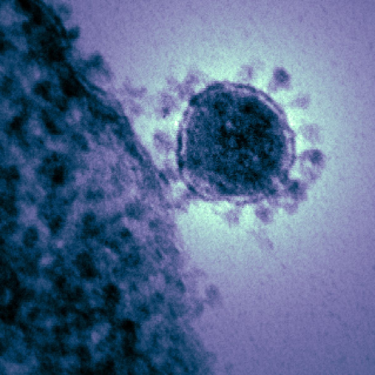 mers related coronavirus